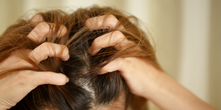 Psoriasis du cuir chevelu - Symptômes et conseils pour soulager le problème