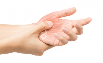 arthrose-acupuncture-homeopathie