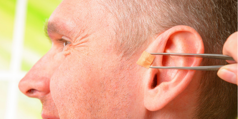 Auriculothérapie ou acupuncture de l'oreille - FMTC Académie